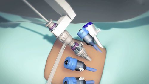 三维医学动画设计制作对医疗行业有什么好处？